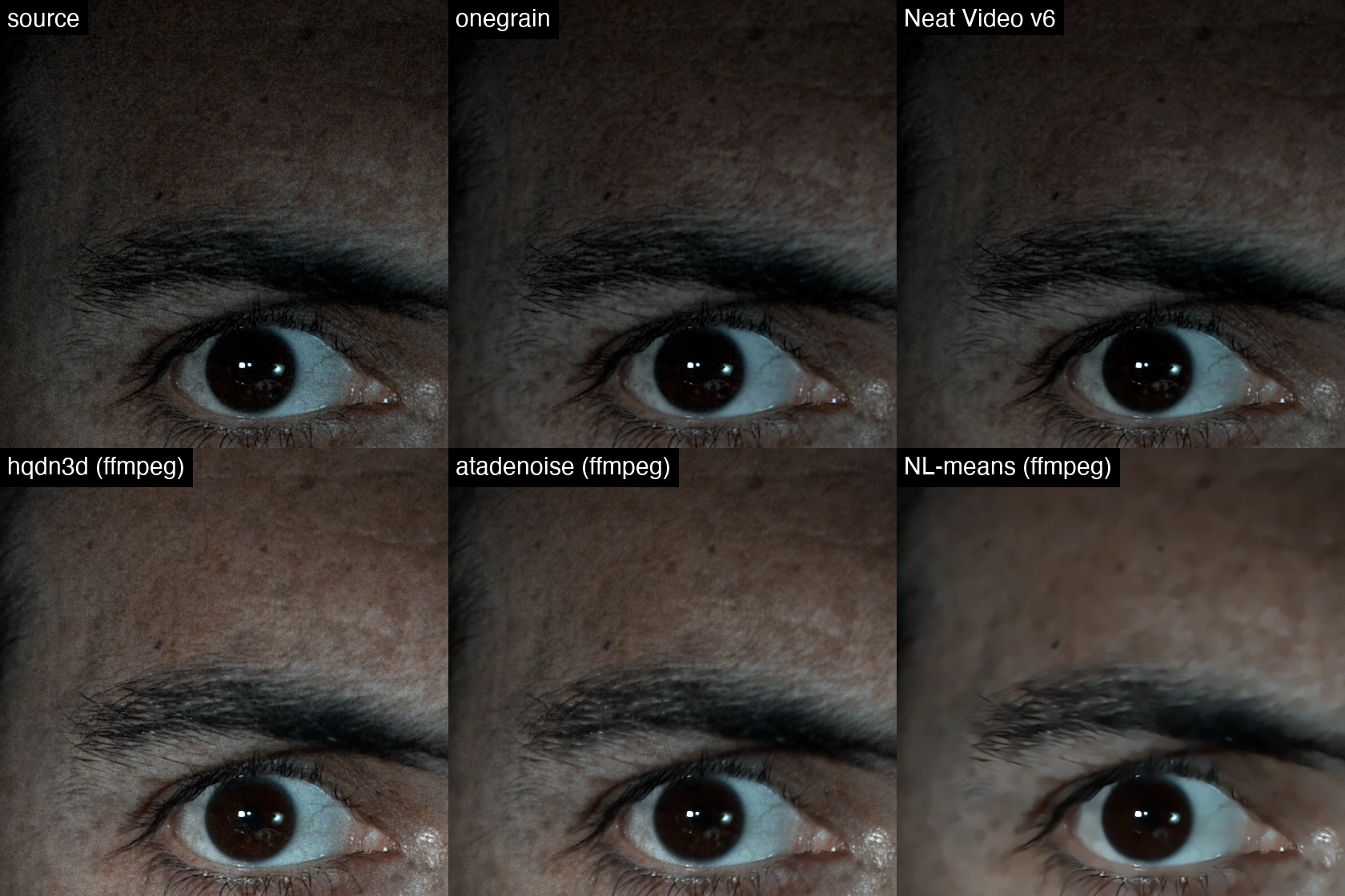 Six close-ups comparing grain removal on the same eye and surrounding skin.